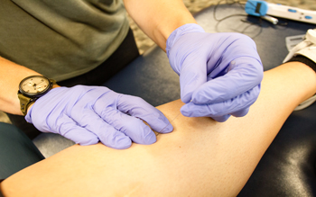 dry needling helps with musculoskeletal pain and dysfunction